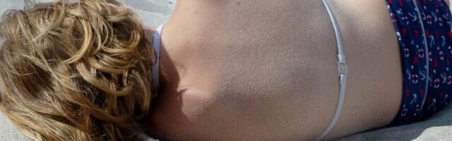 Udruženje obolelih od melanoma: Srbija na prvom mestu po smrtnosti od raka kože
