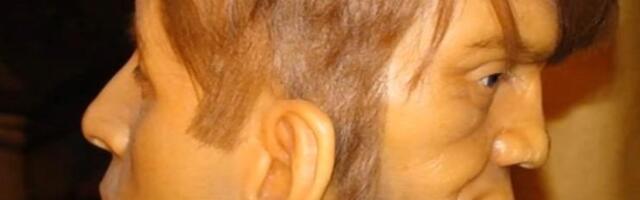 Rođen je sa licem i na potiljku, zvao ga je "đavolji blizanac": Šaputao mu je stvari dok sebi nije presudio u 23. godini