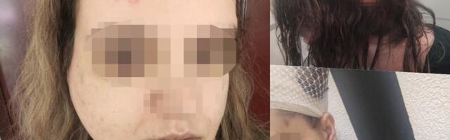 UZNEMIRUJUĆE! MUŽ JE UNAKAZIO NASRED ULICE U BEOGRADU: Udario me 30 puta u glavu! Prekršio je zabranu prilaska, ako ga sad puste, znam šta me čeka (foto)