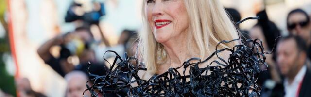 Ketrin O'Hara je otkrila pre nekoliko godina da ima retko genetsko stanje: "Ja sam čudak"