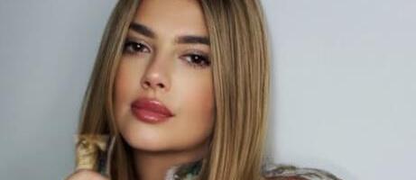 "BIO JE ZAHVATIO SVAKI MIŠIĆ, KOST, GLAVU" Kija Kockar zbog  jedne stvari prošla pakao, a kad čujete razlog sve će vam biti jasno