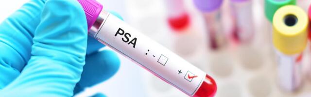Za samo dva dana testirano 1.000 muškaraca u akciji "50+ razloga za PSA test": Veliko interesovanje za preventivne preglede