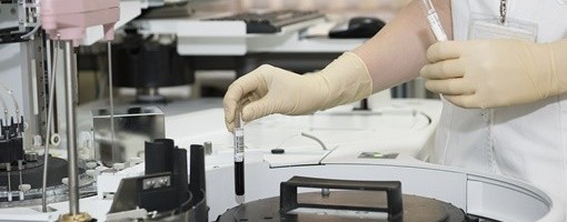 Više od 40 miliona slučajeva zaraze koronavirusom u svetu