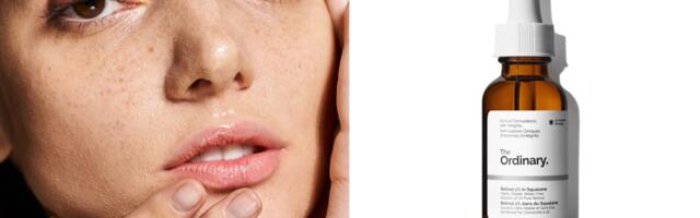 Koristite retinol? Evo šta treba da znate o ovom sastojku i izlaganju suncu