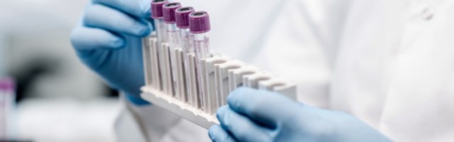 U S. Makedoniji više od 1.000 novoobolelih, umrlo 12 ljudi