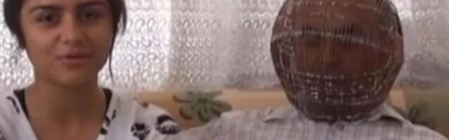 TURČIN STAVIO SKALAMERIJU NA GLAVU I POSTAO GLOBALNA SENZACIJA Zaključao glavu, njegov metod HARA MREŽAMA! (VIDEO)