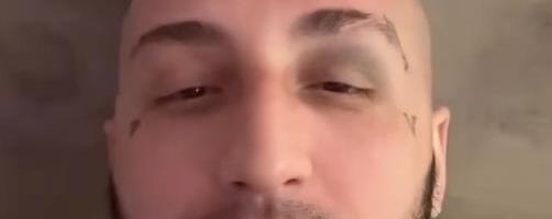 "PUKLE SU MI OBE BUBNE OPNE" Vuk Mob otkrio kroz kakav pakao prolazi nakon boks meča: Hitno otišao kod lekara!