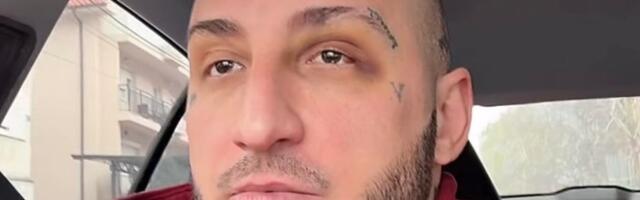 Pukle obe bubne opne, hitno posetio doktora! Vuku Mobu ugroženo zdravlje posle tuče sa Vasom Bakočevićem