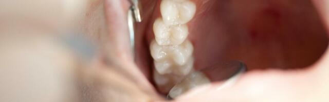 Drama u zubarskoj ordinaciji u Beogradu: Otišao da popravi umnjak, pa ga DVA PUTA OŽIVLJAVALI!