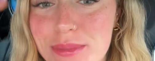 Moja koža je izgorela nakon depilacije obrva zbog jedne ključne greške: Hiljade žena mogle bi da upadnu u istu zamku