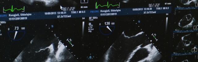 Ginekolog upozorava kada je vreme da tražite pomoć lekara