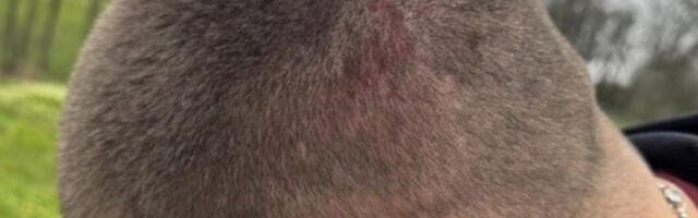 Блокадерски бајкери претукли активисту СНС