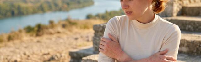 Sve više ljudi u Srbiji ima ovu agresivnu alergiju: Detaljan vodič šta piti, šta jesti, a šta strogo izbegavati!