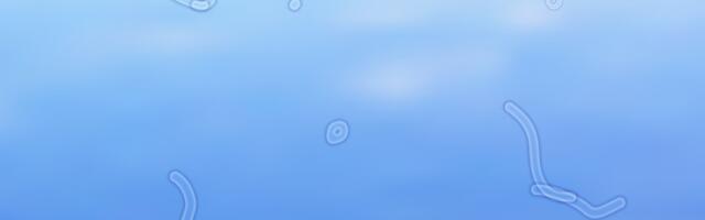 Šta su čudne male stvari koje ponekada plutaju u našem vidnom polju