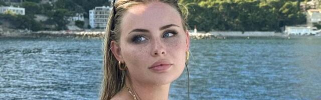 Nega kože tela je u fokusu pred leto: 4 koraka da je poboljšate