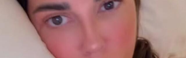 NAŠA DIZAJNERKA NE MOŽE DA "VRATI" STARO LICE NAKON POVREDE: Ni operacija joj nije pomogla, osvanuo novi snimak!