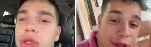 Poznata inluenserka optužila Luku Silnog za nasilje: "Udario me pesniom u glavu, dala sam mu 1.500 evra"