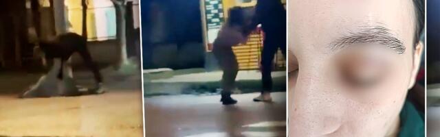 Ovo nije prvi put: Oglasila se devojka koju je golman tukao nasred ulice u Kikindi