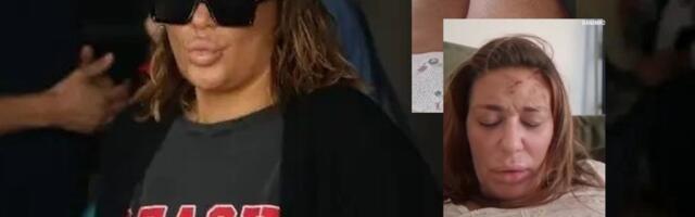 SNIMAK Ane Nikolić posle sukoba s Raletom rastužuje: Krvava, uplakana, u ožiljcima, moli za pomoć