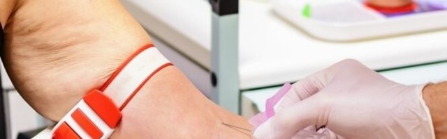 Krv mladih ljudi može da preokrene proces starenja!?