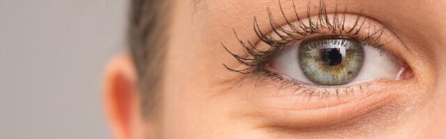 5 načina da se brzo rešite podočnjaka i otečenosti - Sigurno sve već imate KOD KUĆE