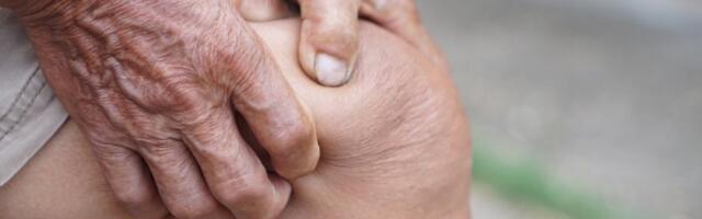 Ovaj recept rešava bolove od artritisa za 10 dana: Dovoljan je jedan tretman da osetite olakšanje