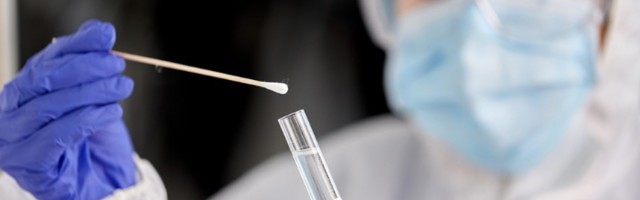 Više od 3.000 novozaraženih, preminule 44 osobe