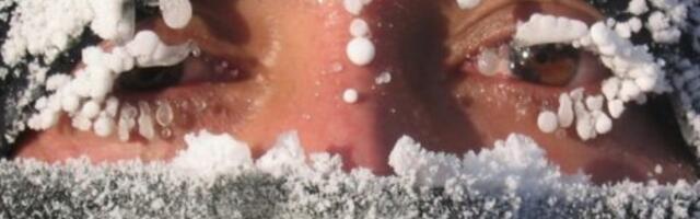 Antifriz krema koja štiti naše tkivo od promrzlina