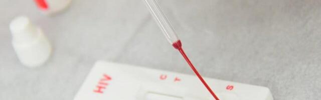 Testiranje na HIV besplatno i bez zakazivanje u utorak u Nišu