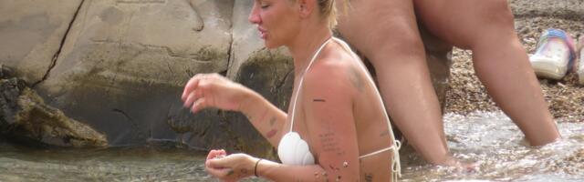 Milica Dabović PREŽIVELA PAKAO: 12 dana trpela NESNOSNE MUKE, a tek je čeka JOŠ JEDNA OPERACIJA - Evo u kakvom je stanju! (FOTO)