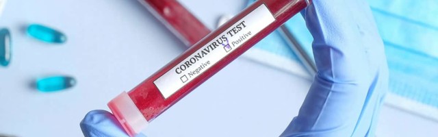 Kod starije žene iz Čačka potvrđen koronavirus