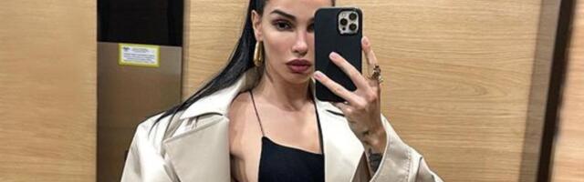 (FOTO)  "GLEDAM KAKO MI KOSA OPADA" Jedna od najfatalnijih Srpkinja saznala da ima zdravstveni problem po frizuri: Ovo mi je znak za uzbunu!