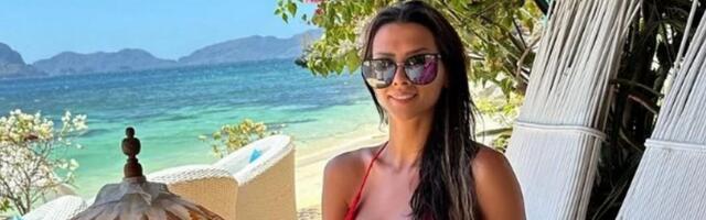"Dobila sam opekotine trećeg stepena" Naša pevačica otkrila kroz kakav je pakao prošla: "Nisam osetila..."