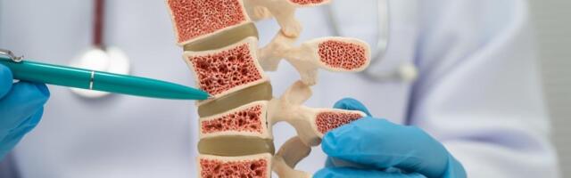 Novo otkriće daje nadu obolelima od osteoporoze: Naučnici uspeli da podstaknu rast novih kostiju