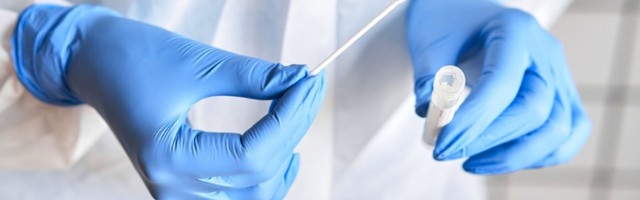 Najveći dnevni broj umrlih u Sloveniji od početka epidemije