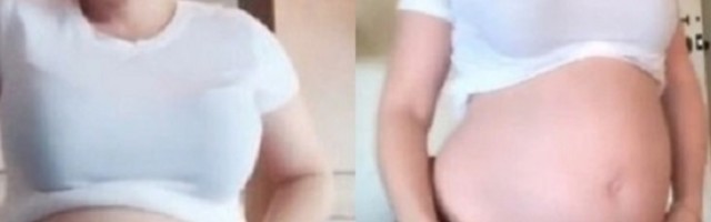"Zatrudnela sam i shvatila da nosim blizance, a 10 dana kasnije usledio je šok"!