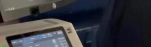 OSVANUO ULTRAZVUK BEBE MILICE MITROVIĆ! Nacija nikad srećnija zbog PRINOVE - evo kako izgleda!