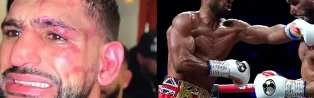 Amir Kan nakon poraza pokazao svoje povrede i priznao da razmatra penzionisanje