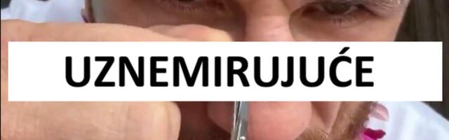 Nije za one sa slabim stomakom: UFC borac skidao sam sebi konce sa lica, sve prenosio uživo! /VIDEO/