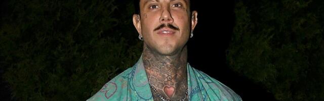 FILIP ĐUKIĆ IMA OZBILJAN ZDRAVSTVENI PROBLEM, otkrio detalje: "Nisam više onaj stari, a pričali su da se foliram"