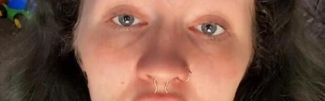 Žena bez zuba i obrva se pretvara u lepoticu (VIDEO)