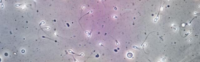 Revolucionarni medicinski poduhvat: Muškarac proizveo spermatozoide iz tkiva zamrznutog kad je bio dete