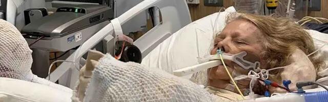 Žena (82) zaspala na suncu, sada se bori za život: "Svaki deo tela koji je dotakao stolicu bio je spržen"