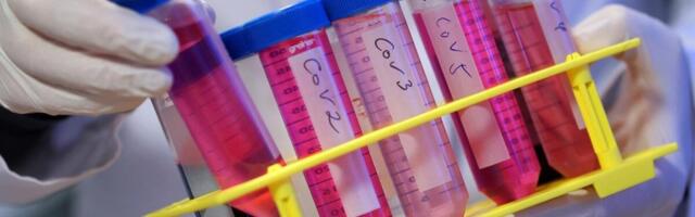 NAUČNICA UKRALA OPASNE VIRUSE IZ LABORATORIJE: Upala u prostor koji ima NAJVIŠI nivo bezbednosti, kolege u šoku