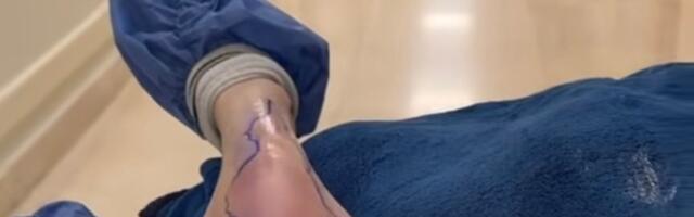 Otrovni pauk prekinuo turneju: Pevačica završila u bolnici, ali poručila: "Šou mora da se nastavi“