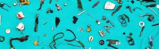 Hirurg izvadio 60 kućnih predmeta iz čovekovog stomaka