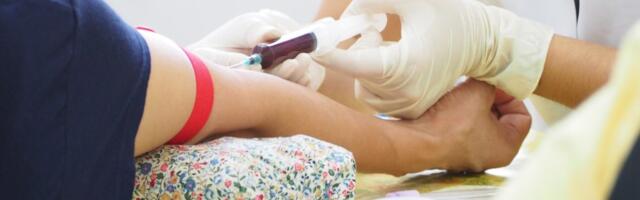 Naizgled zdrav, ali u riziku: Kako kontrola holesterola može spasiti život