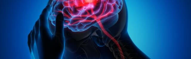 Usled vrućina 50 % više pacijenata sa moždanim udarima