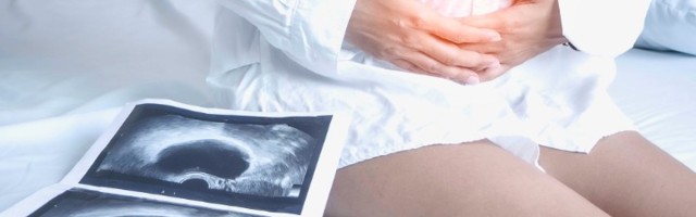 Ciste na jajnicima: Šta sve mogu da urade vašem telu