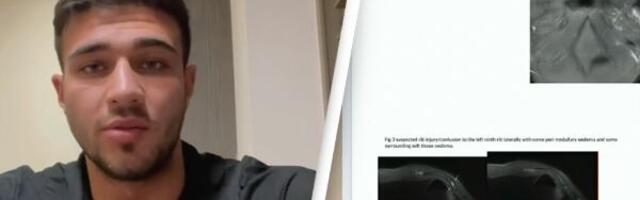 Tomi Fjuri predstavio dokaze o povredi kako bi ućutkao brbljivog jutjubera